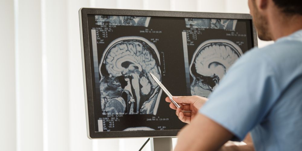 Tumores cerebrais