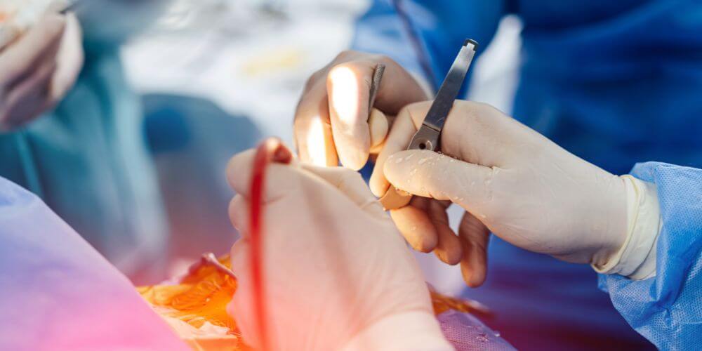 neurocirurgia funcional Rio de Janeiro